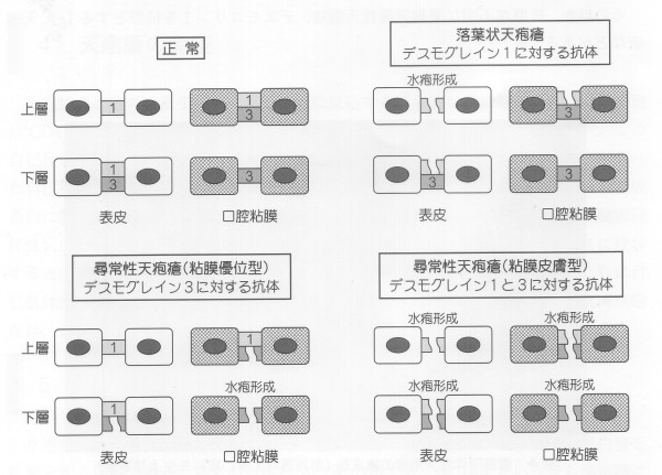 畆U