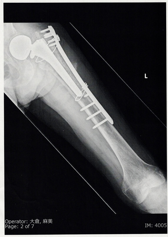 11月21日レントゲンB